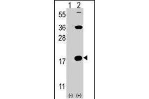 Western blot analysis of CD247 (arrow) using rabbit CD247 polyclonal antibody . (CD247 抗体  (C-Term))
