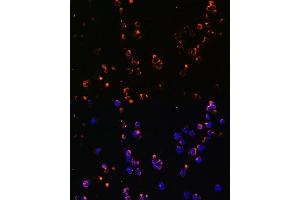 Immunofluorescence analysis of Jurkat cells using CD27 antibody (ABIN3022680, ABIN3022681, ABIN3022682 and ABIN6219092) at dilution of 1:100. (CD27 抗体  (AA 20-191))