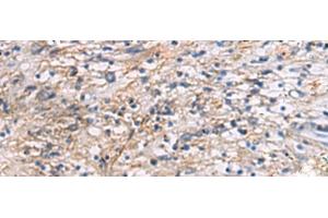 Immunohistochemistry of paraffin-embedded Human brain tissue using CEP89 Polyclonal Antibody at dilution of 1:95(x200) (CEP89 抗体)