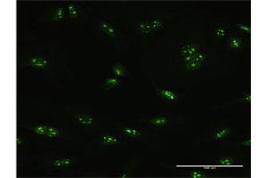 Immunofluorescence of purified MaxPab antibody to PNO1 on HeLa cell. (PNO1 抗体  (AA 1-252))
