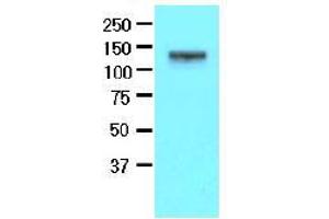 Western Blotting (WB) image for anti-EPH Receptor A2 (EPHA2) (AA 559-976) antibody (ABIN317512) (EPH Receptor A2 抗体  (AA 559-976))