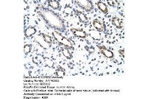 Immunohistochemistry (IHC) image for anti-KH Domain Containing, RNA Binding, Signal Transduction Associated 3 (KHDRBS3) (C-Term) antibody (ABIN2778997)