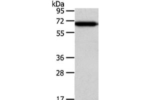 Western Blot analysis of Hepg2 cell using USP39 Polyclonal Antibody at dilution of 1/400 (USP39 抗体)