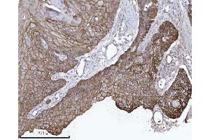 IHC analysis of CTNND1 using anti-CTNND1 antibody (ABIN7602220).