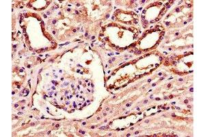 Immunohistochemistry of paraffin-embedded human kidney tissue using ABIN7143254 at dilution of 1:100 (Acylglycerol Kinase 抗体  (AA 32-65))
