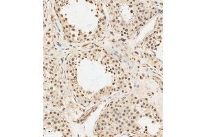 (ABIN6243447 and ABIN6578904) staining METTL14 in human testis tissue sections by Immunohistochemistry (IHC-P - paraformaldehyde-fixed, paraffin-embedded sections). (METTL14 抗体  (AA 2-36))