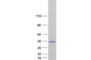 Western Blotting (WB) image for Spermatogenesis Associated 24 (SPATA24) protein (Myc-DYKDDDDK Tag) (ABIN2723174)
