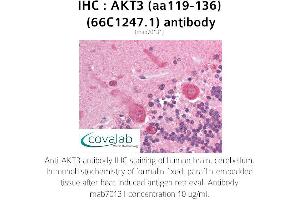 Image no. 1 for anti-V-Akt Murine Thymoma Viral Oncogene Homolog 3 (Protein Kinase B, Gamma) (AKT3) (AA 119-136) antibody (ABIN1723080) (AKT3 抗体  (AA 119-136))