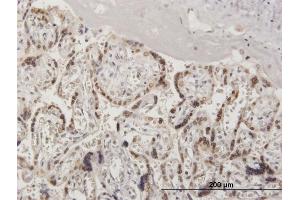 Immunoperoxidase of purified MaxPab antibody to RANGAP1 on formalin-fixed paraffin-embedded human placenta. (RANGAP1 抗体  (AA 1-587))