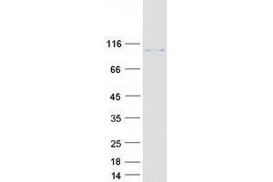 Western Blotting (WB) image for Calcium Binding and Coiled-Coil Domain 1 (CALCOCO1) (Transcript Variant 1) protein (Myc-DYKDDDDK Tag) (ABIN2713042)