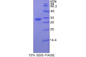 SDS-PAGE analysis of Rat ETFa Protein. (Electron-Transfer-Flavoprotein, alpha Polypeptide (ETFA) Peptide)