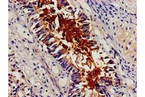 Immunohistochemistry (IHC) image for anti-Breast Cancer Anti-Estrogen Resistance 1 (BCAR1) (AA 68-218) antibody (ABIN7145766)