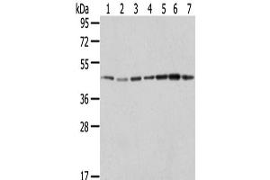 Western Blot analysis of Raji, A549, Hela, HepG2, 231, K562 and A431 cells using ERP44 Polyclonal Antibody at dilution of 1/200 (ERP44 抗体)