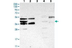 Western blot analysis of Lane 1: RT-4, Lane 2: U-251 MG, Lane 3: Human Plasma, Lane 4: Liver, Lane 5: Tonsil with FEZ2 polyclonal antibody  at 1:250-1:500 dilution. (FEZ2 抗体)