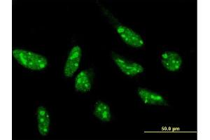 Immunofluorescence of purified MaxPab antibody to SNIP1 on HeLa cell. (SNIP1 抗体  (AA 1-396))