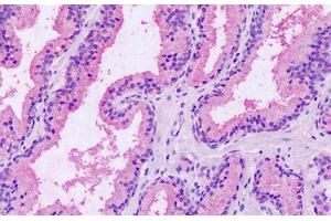 Anti-GPRC5A / RAI3 antibody IHC staining of human prostate. (GPRC5A 抗体  (Extracellular Domain))
