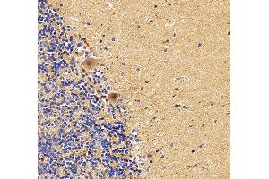 IHC analysis of SNAP23 using anti-SNAP23 antibody (ABIN7599089).