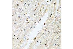 Immunohistochemistry of paraffin-embedded mouse heart using PNKP antibody.