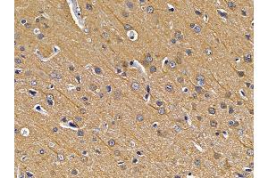 ABIN7094210 and ABIN7098256 at 1/100 staining rat brain tissue by IHC-P. (EXOSC10 抗体  (Internal Region))
