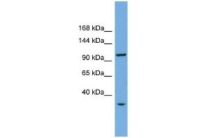 CHTF18 antibody used at 1 ug/ml to detect target protein. (CTF18 抗体)