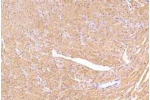 Immunohistochemistry analysis of paraffin-embedded mouse heart using,PSKH1 (ABIN7075291) at dilution of 1: 2800 (PSKH1 抗体)
