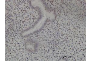 Immunoperoxidase of monoclonal antibody to NEK11 on formalin-fixed paraffin-embedded human endometrium tissue. (NEK11 抗体  (AA 1-482))