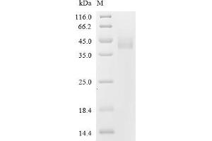 (Tris-Glycine gel) Discontinuous SDS-PAGE (reduced) with 5 % enrichment gel and 15 % separation gel.