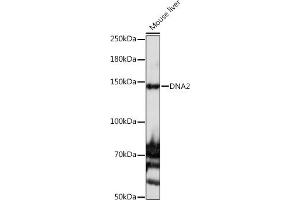 Western blot analysis of extracts of Mouse liver, using DN antibody (ABIN6135118 and ABIN6139689) at 1:1000 dilution. (DNA2 抗体)