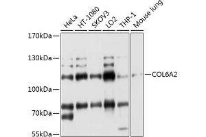 Western blot analysis of extracts of various cell lines, using COL6 antibody (ABIN1679319, ABIN3018110, ABIN3018111 and ABIN6220367) at 1:1000 dilution.