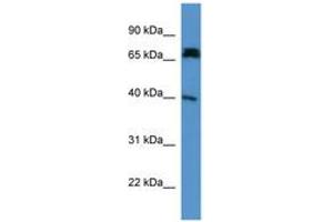 Image no. 1 for anti-Doublecortin Domain Containing 2 (DCDC2) (AA 79-128) antibody (ABIN6746477) (DCDC2 抗体  (AA 79-128))