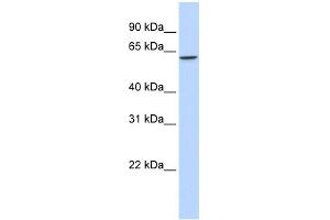 WB Suggested Anti-TBX22 Antibody Titration:  0. (T-Box 22 抗体  (Middle Region))