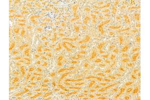 ABIN6265156 and ABIN6278272 at 1/100 staining Rat kidney tissue by IHC-P.