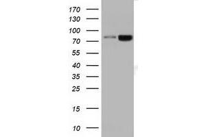 HEK293T cells were transfected with the pCMV6-ENTRY control (Left lane) or pCMV6-ENTRY DGKB (Right lane) cDNA for 48 hrs and lysed. (DGKB 抗体)