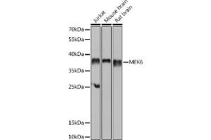 Western blot analysis of extracts of various cell lines, using MEK6 antibody (ABIN6130546, ABIN6143490, ABIN6143491 and ABIN6218471) at 1:1000 dilution. (MAP2K6 抗体  (AA 1-334))