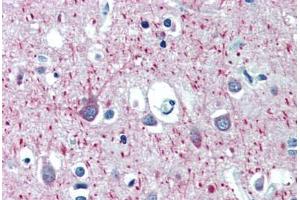 Human Brain, Cortex (formalin-fixed, paraffin-embedded) stained with MAP2 antibody ABIN462127 followed by biotinylated anti-mouse IgG secondary antibody ABIN481714, alkaline phosphatase-streptavidin and chromogen. (MAP2 抗体)