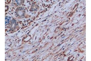 Immunohistochemistry (IHC) image for anti-Vimentin (VIM) antibody (ABIN7426163)