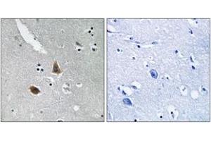Immunohistochemistry analysis of paraffin-embedded human brain tissue, using MRPL21 Antibody. (MRPL21 抗体  (AA 131-180))