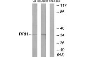 Western blot analysis of extracts from Jurkat/COLO cells, using RRH Antibody.
