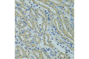 Immunohistochemistry of paraffin-embedded mouse kidney using PECR antibody (ABIN5975099) at dilution of 1/100 (40x lens). (PECR 抗体)
