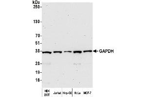 Western Blotting (WB) image for anti-Glyceraldehyde-3-Phosphate Dehydrogenase (GAPDH) (AA 150-200) antibody (ABIN7454519) (GAPDH 抗体  (AA 150-200))
