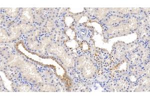 Detection of NECTIN2 in Human Kidney Tissue using Monoclonal Antibody to Nectin 2 (NECTIN2)