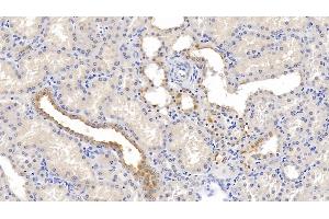 Detection of NECTIN2 in Human Kidney Tissue using Monoclonal Antibody to Nectin 2 (NECTIN2) (PVRL2 抗体  (AA 76-353))