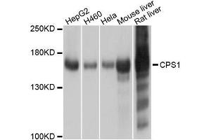 Western blot analysis of extracts of various cell lines, using CPS1 antibody. (CPS1 抗体  (AA 820-930))