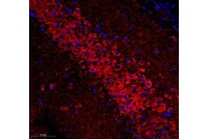 Immunofluorescence (Paraffin-embedded Sections) (IF (p)) image for anti-ATP Synthase, H+ Transporting, Mitochondrial F0 Complex, Subunit C1 (Subunit 9) (ATP5G1) antibody (ABIN7073141)