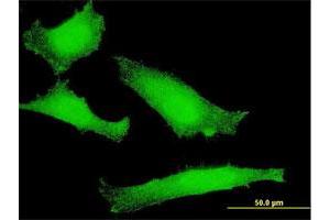 Immunofluorescence of monoclonal antibody to FOXO1 on HeLa cell. (FOXO1 抗体  (AA 556-655))