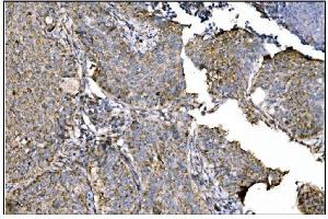 IHC analysis of Ornithine Aminotransferase/OAT using anti-Ornithine Aminotransferase/OAT antibody (ABIN7600649). (OAT 抗体  (AA 214-439))