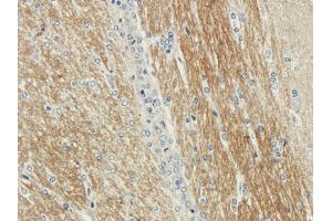 Immunohistochemical staining of rabbit brain using anti-CDCrel-1 antibody ABIN7072252 Formalin fixed rabbit brain slices were were stained with ABIN7072250 at 3 μg/mL. (Recombinant Septin 5 抗体)