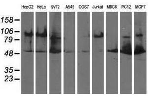 Image no. 2 for anti-Dihydrolipoamide Dehydrogenase (DLD) antibody (ABIN1497849) (DLD 抗体)