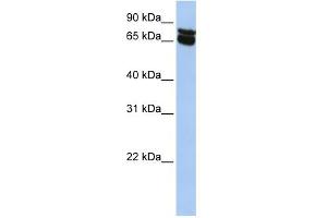 WB Suggested Anti-B4GALNT1 Antibody Titration:  0. (B4GALNT1 抗体  (N-Term))