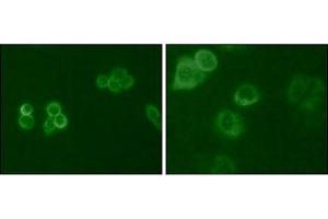 Immunofluorescence analysis of Hela (Left) and MCF-7 (Right) cells using Tyro3 mouse mAb (green). (TYRO3 抗体  (AA 138-321))